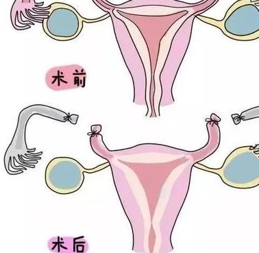 2026年拉拉去山西省人民医院做精子试管的成功率高吗？详细步骤介绍